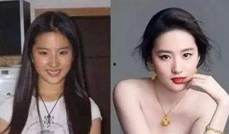 整容师看明星网红视频,整容师视角下的美丽蜕变