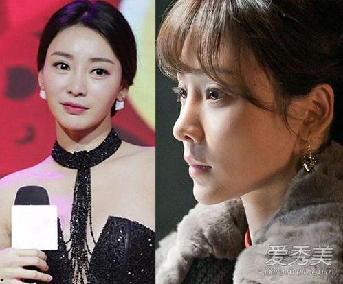 明星网红整容对比图片女,明星整容前后惊人对比